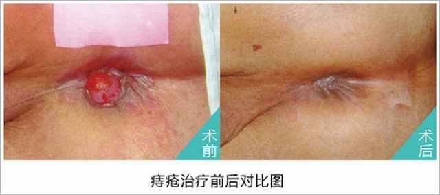 前后.jpg